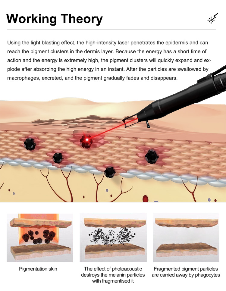 Non invasive Laser Skin Care02